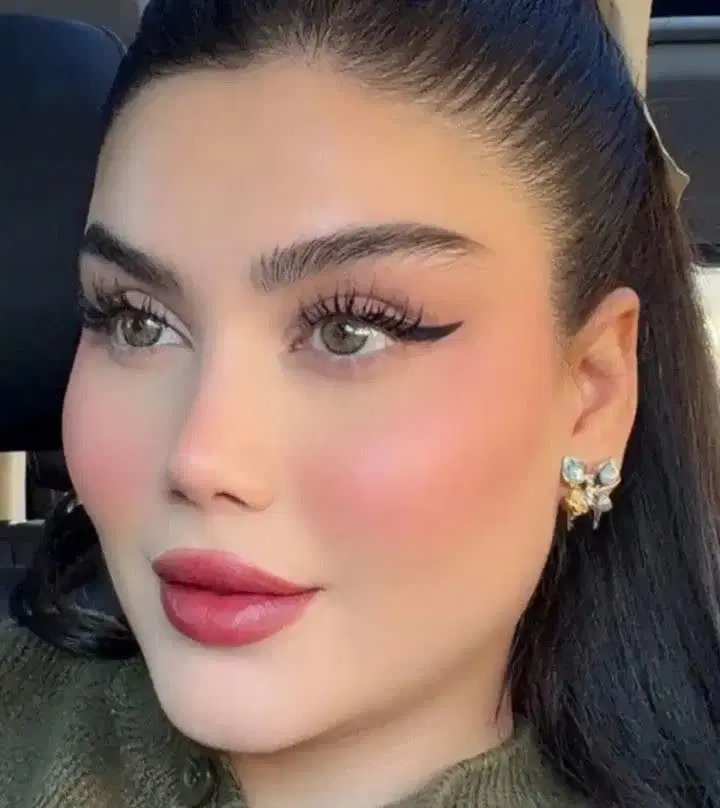 تخفیف ویژه ژل بوتاکس پلاسماژل فیلر توسط پزشک|خدمات زیبایی و سلامت|کرمانشاه, |دیوار