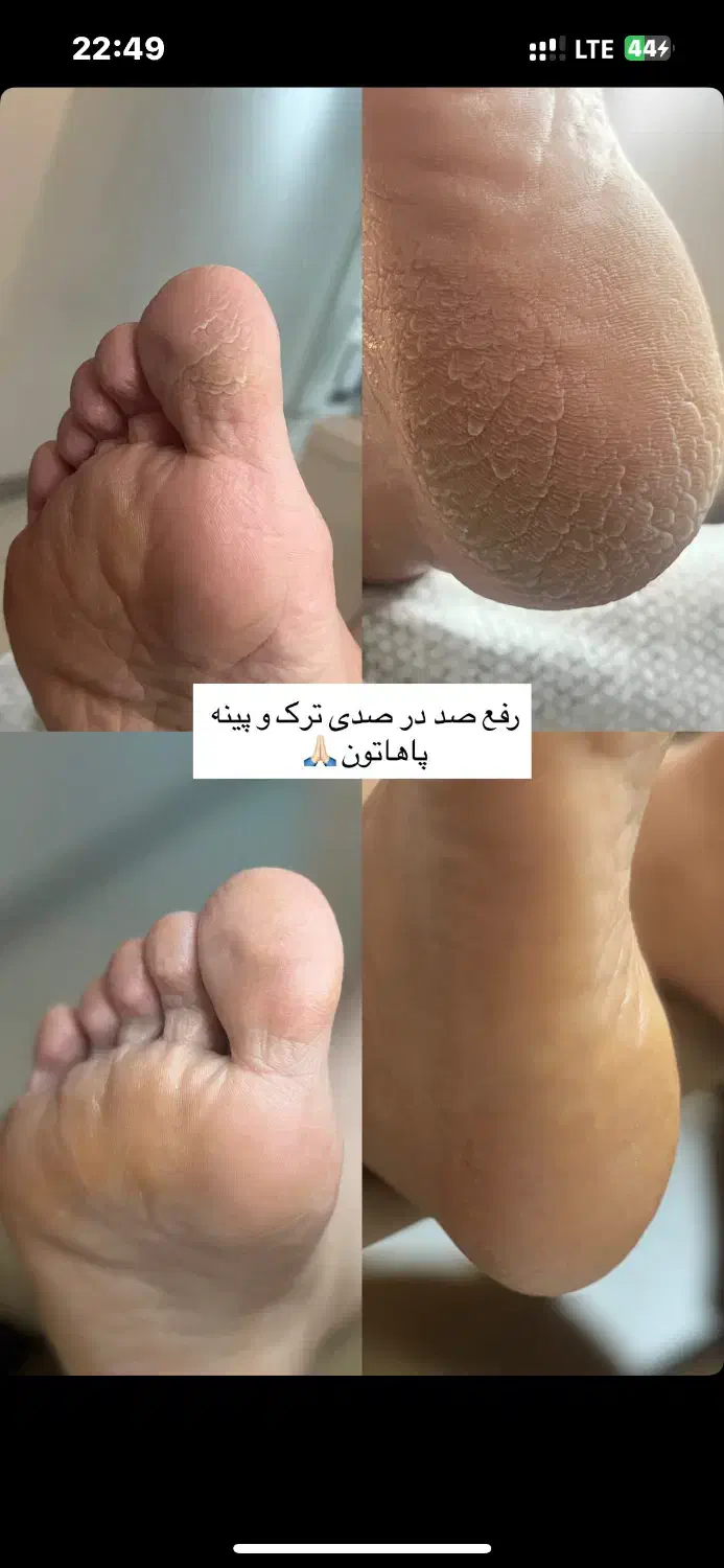 ۱ نفر ظرفیت برای کفسابی یا ژلیش یکشنبه|خدمات آرایشگری و زیبایی|رشت, گلباغ نماز|دیوار