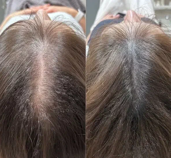 خواهان مدل برای prp مو و صورت|خدمات آرایشگری و زیبایی|سنندج, |دیوار