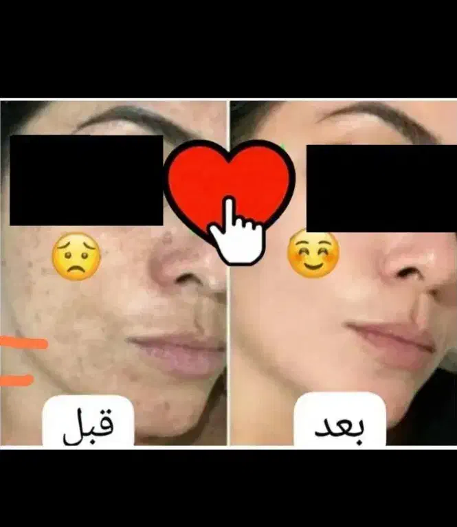 کرم معجزه اصل با گارانتی مرجوعی|آرایشی، بهداشتی، درمانی|سرپل ذهاب, |دیوار