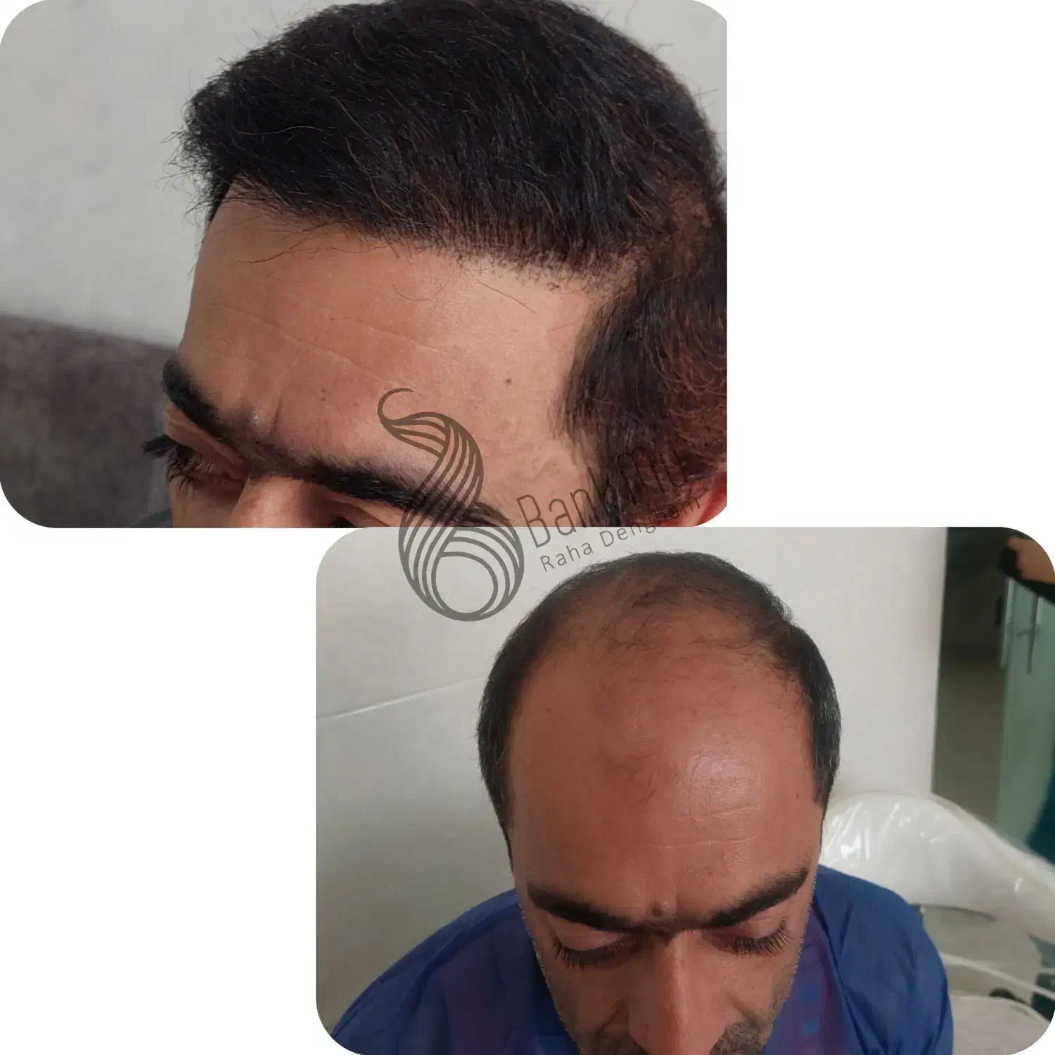 مرکزتخصصی کاشت مو|خدمات آرایشگری و زیبایی|شیراز, ارم|دیوار
