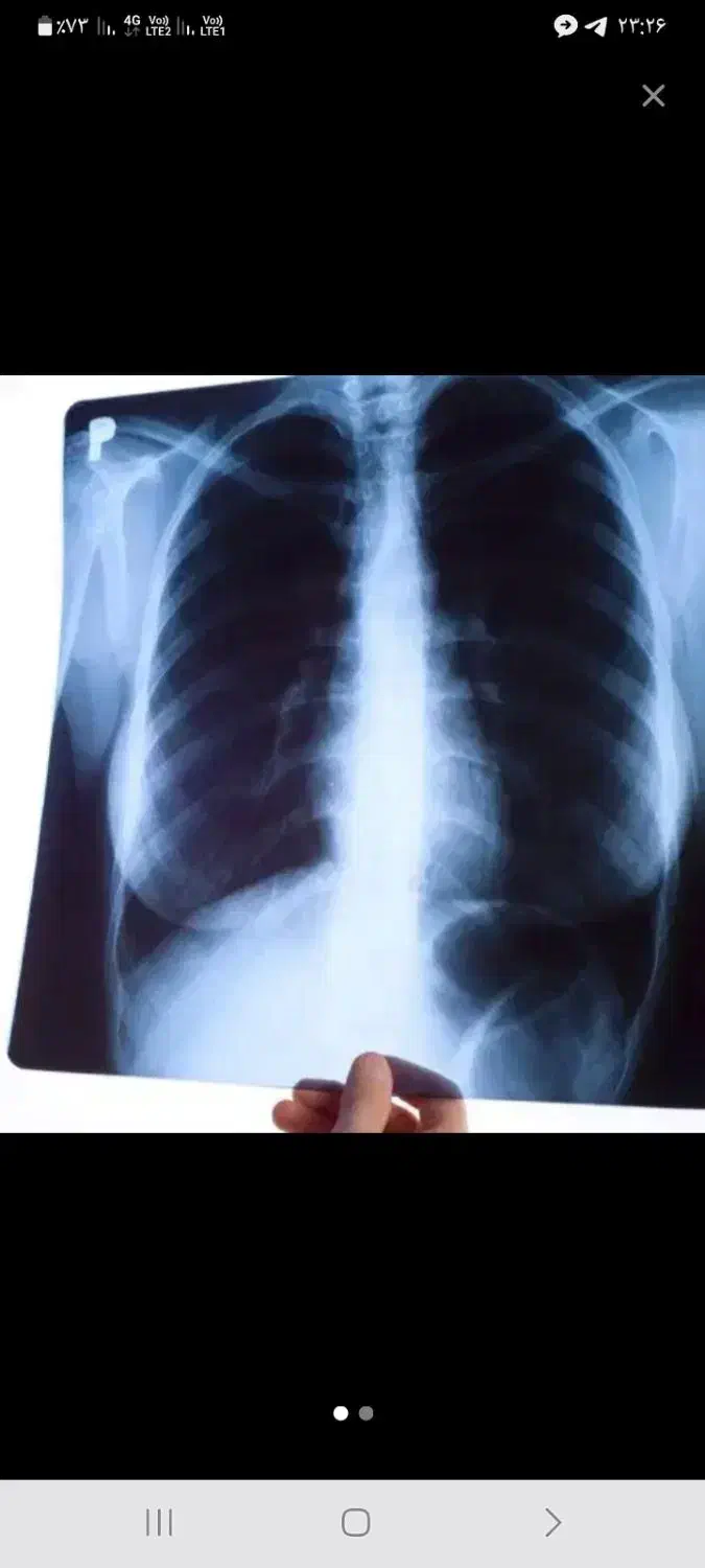 خرید عکس رادیولوژی ۲۵۰|خدمات پیشه و مهارت|قم, باغ کرباسی|دیوار