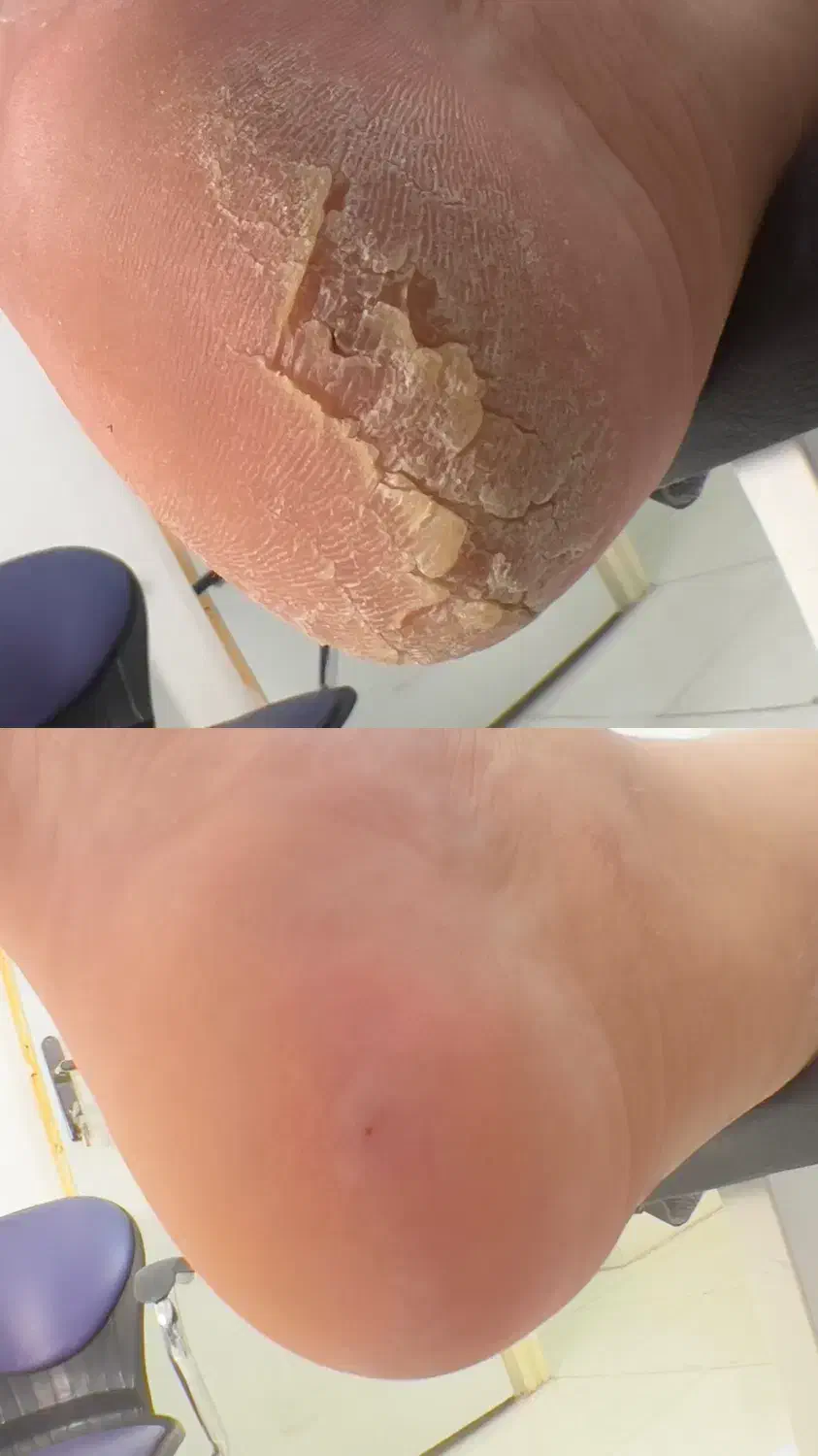 خدمات پدیکور ۴۰۰ تومان|خدمات آرایشگری و زیبایی|خرم‌آباد, |دیوار