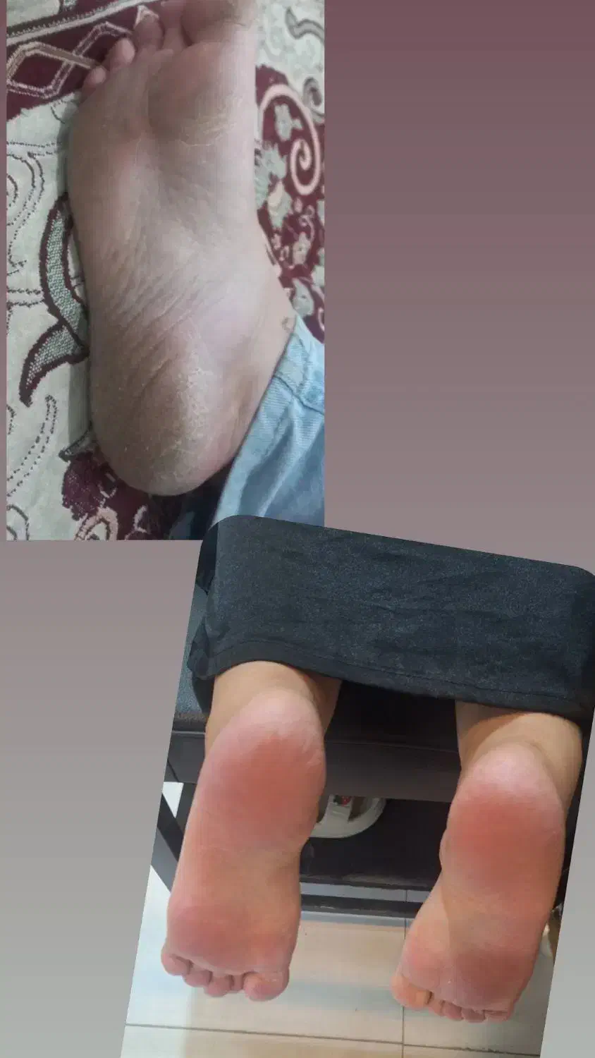 پدیکور. پا|خدمات آرایشگری و زیبایی|یاسوج, |دیوار