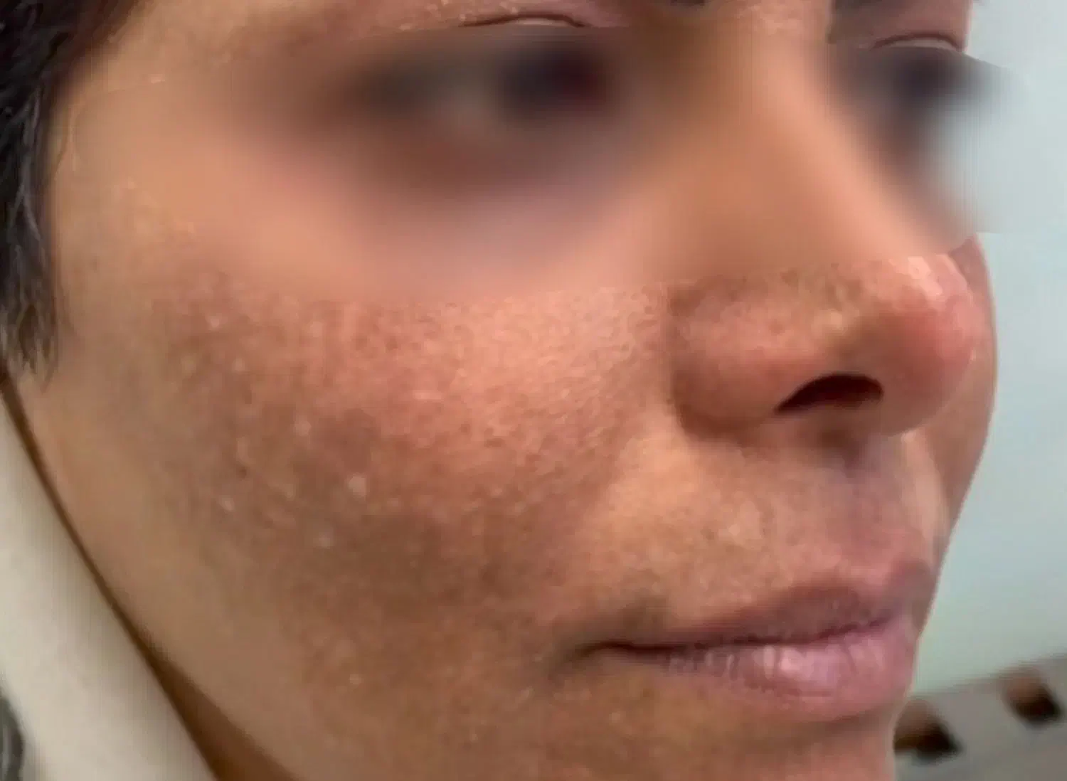 اماراتی ضدلک ترکیبی|آرایشی، بهداشتی، درمانی|خورموج, |دیوار