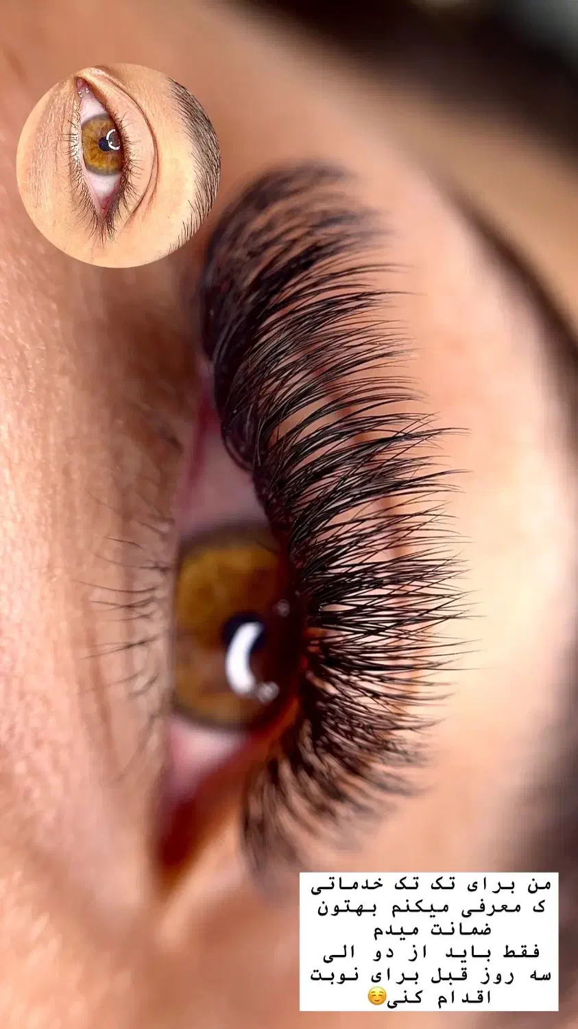 اپلاسیون‌سبحانی|خدمات آرایشگری و زیبایی|مشهد, ابوذر|دیوار