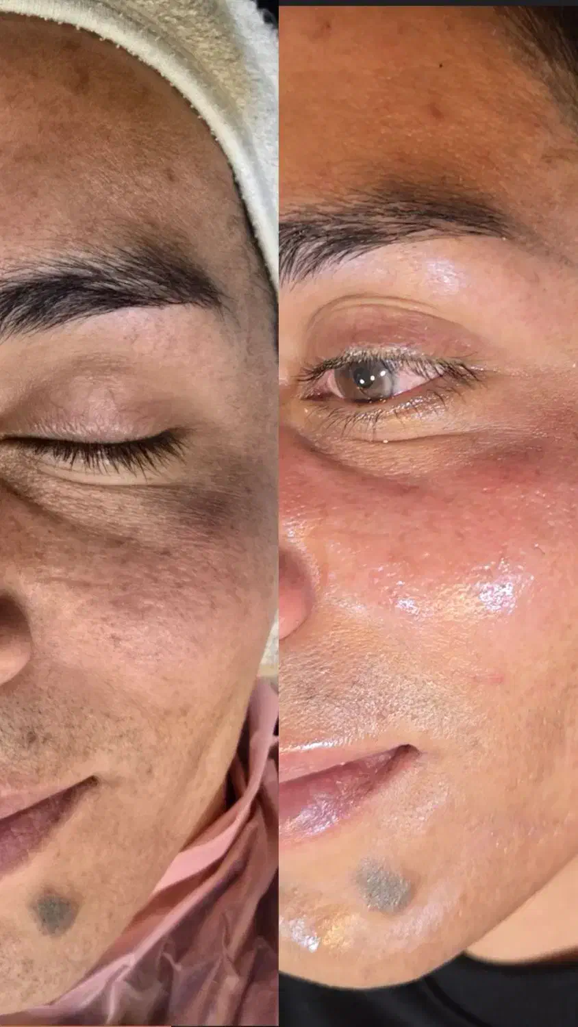 درمان مشکلات پوستی تخصصی|آرایشی، بهداشتی، درمانی|ارومیه, |دیوار