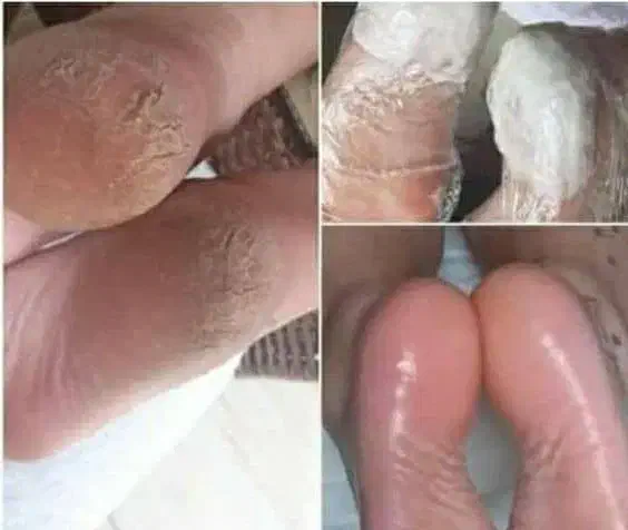 کفسابی پدیکور و رفع تیرگی تخفیف ب مدت ۲ روز|خدمات آرایشگری و زیبایی|فولادشهر, B2|دیوار