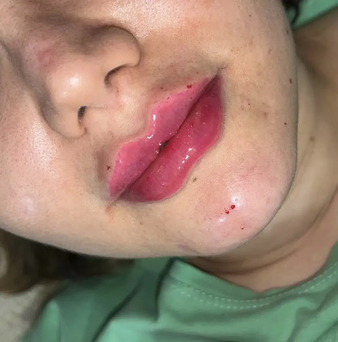 ژل و بوتاکس|خدمات آرایشگری و زیبایی|تاکستان, |دیوار