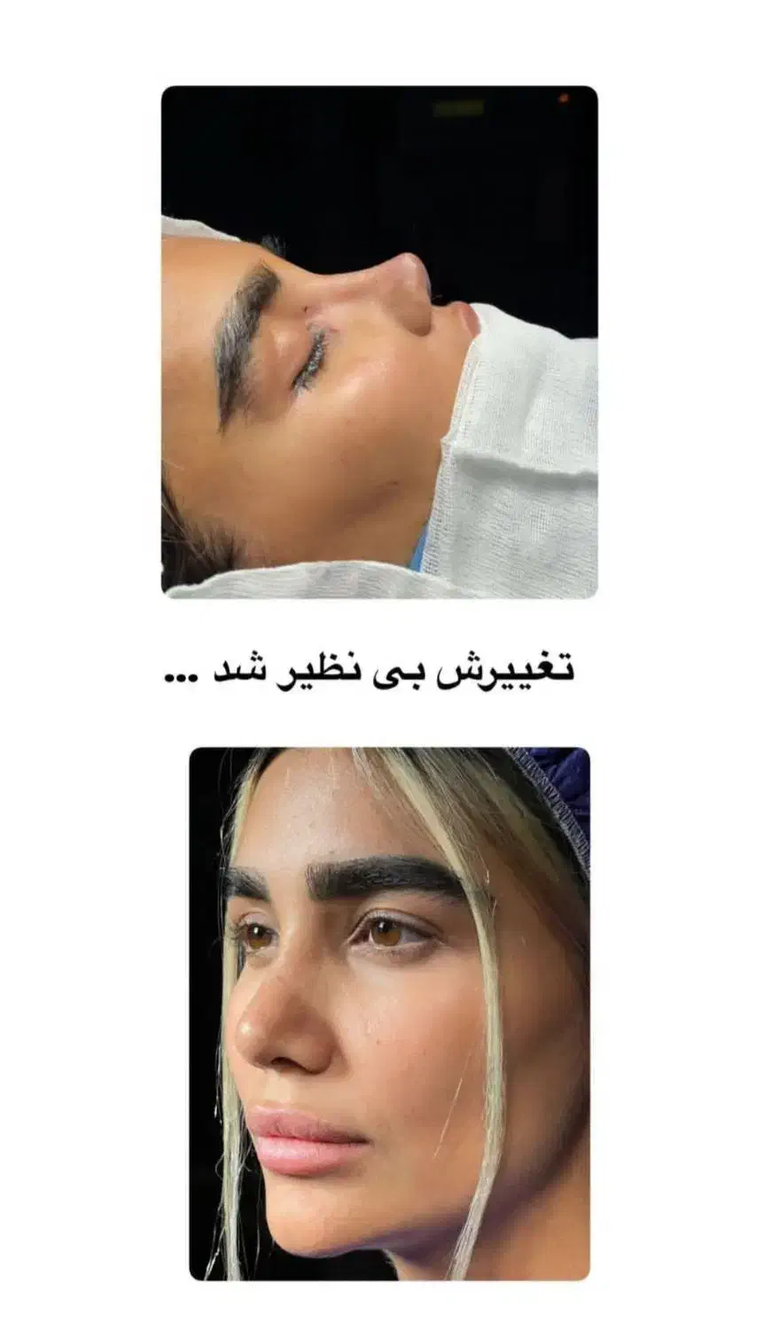 عمل بینی|خدمات آرایشگری و زیبایی|محمدشهر, محمدشهر|دیوار