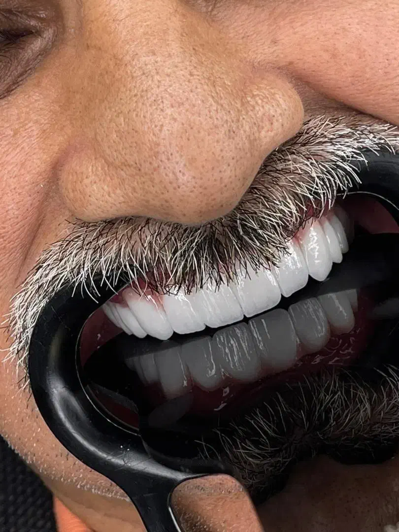 استخدام منشی تلفنی برای کالسنتر دندانپزشکی|استخدام بازاریابی و فروش|تهران, فلسطین (میدان انقلاب)|دیوار