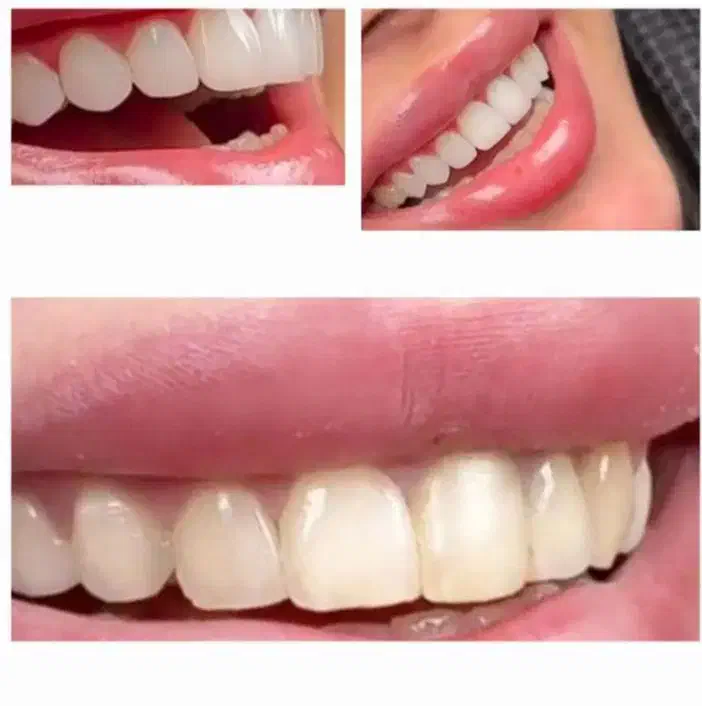 آموزش کامل دندانپزشکی . .بصورت اقساطی|خدمات آموزشی|بابل, |دیوار