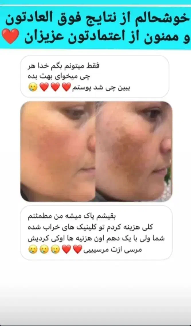 صابون لایه بردار گیاهی روشن کننده صورت وبدن|آرایشی، بهداشتی، درمانی|اهواز, آریاشهر|دیوار