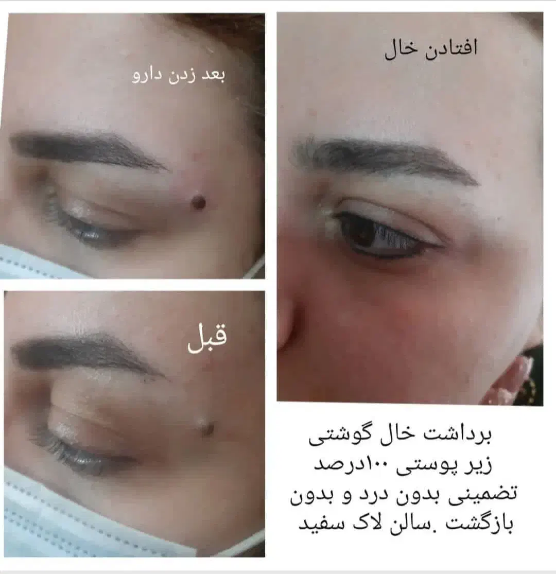 پوست زیبایی|خدمات آرایشگری و زیبایی|رباط‌کریم, الارد|دیوار