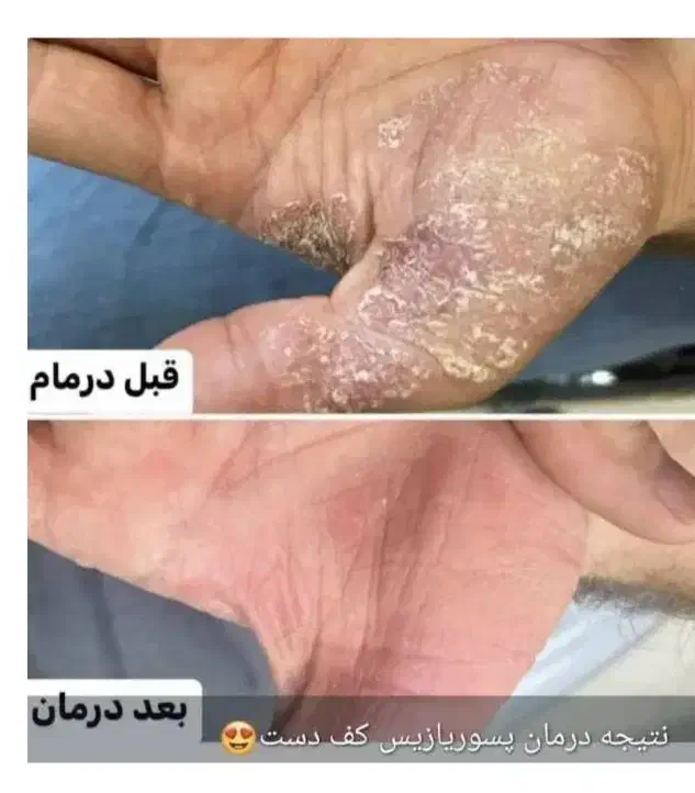 مزاج شناسی و پاکسازی|آرایشی، بهداشتی، درمانی|اهواز, امانیه|دیوار