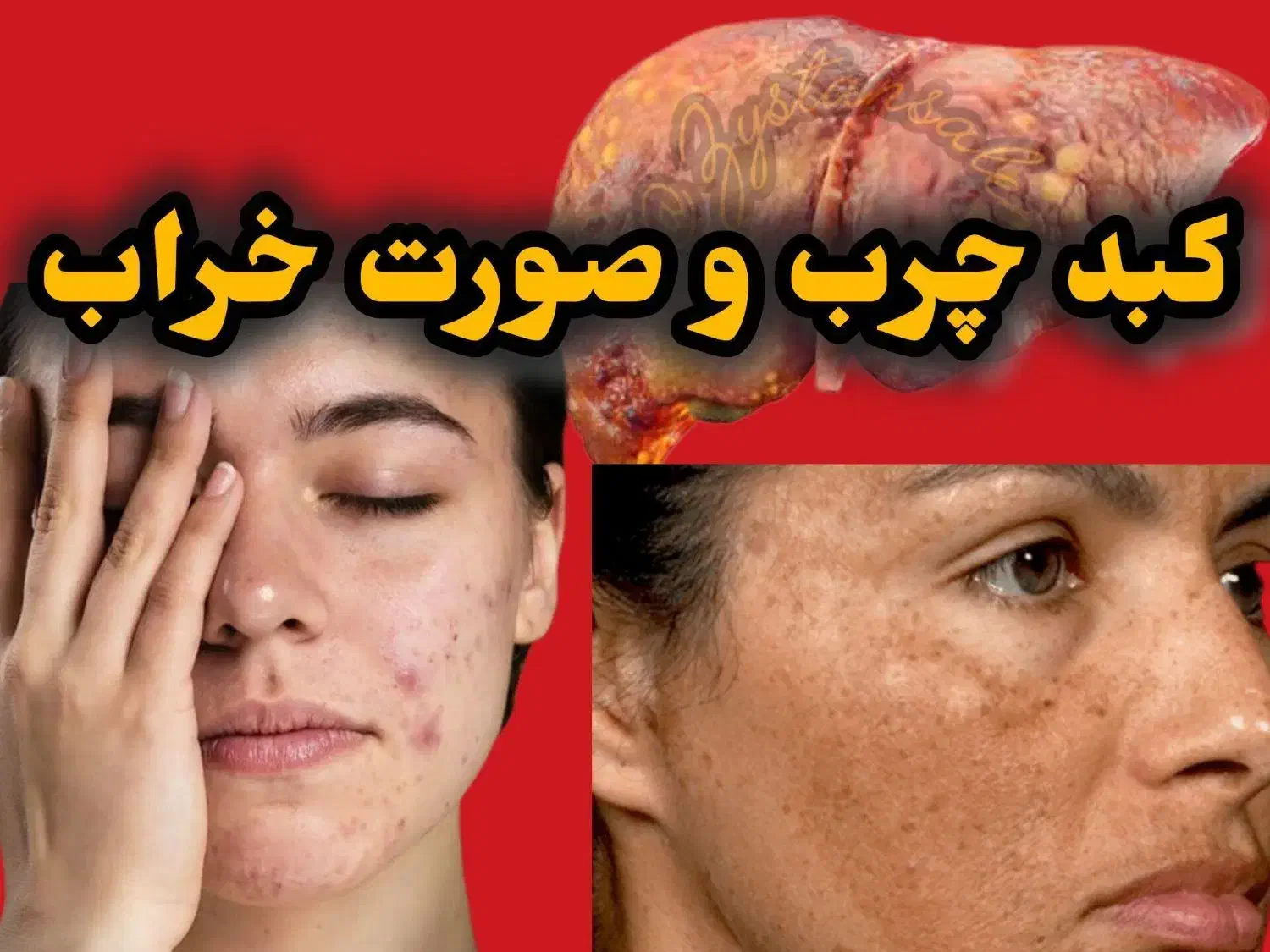 قاتل کبد چرب|آرایشی، بهداشتی، درمانی|تاکستان, |دیوار