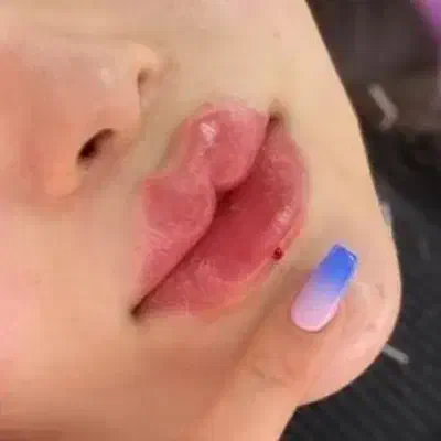 ژل بوتاکس مزو انزیم .پرسینگ .لیفت نخ .چال لپ|خدمات آرایشگری و زیبایی|شاهینشهر, شهرک پردیس|دیوار