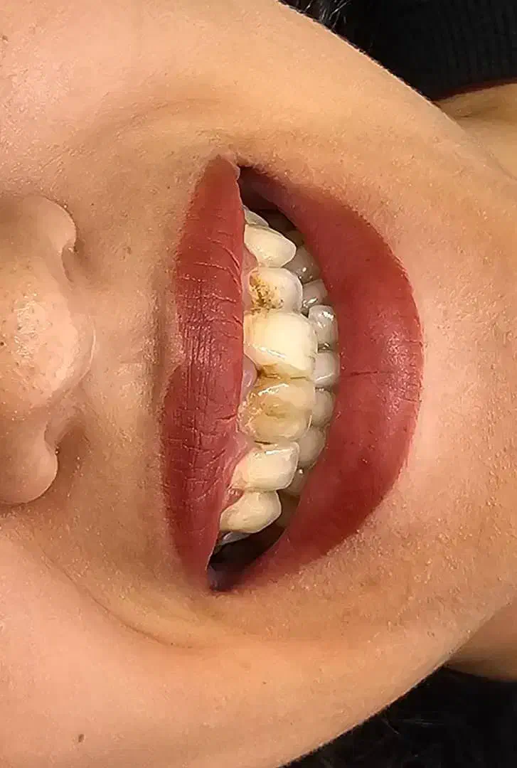 خدمات دندان پزشکی با تخفیف ویژه پاییز ( 50٪ )سنندج|خدمات آرایشگری و زیبایی|مریوان, |دیوار