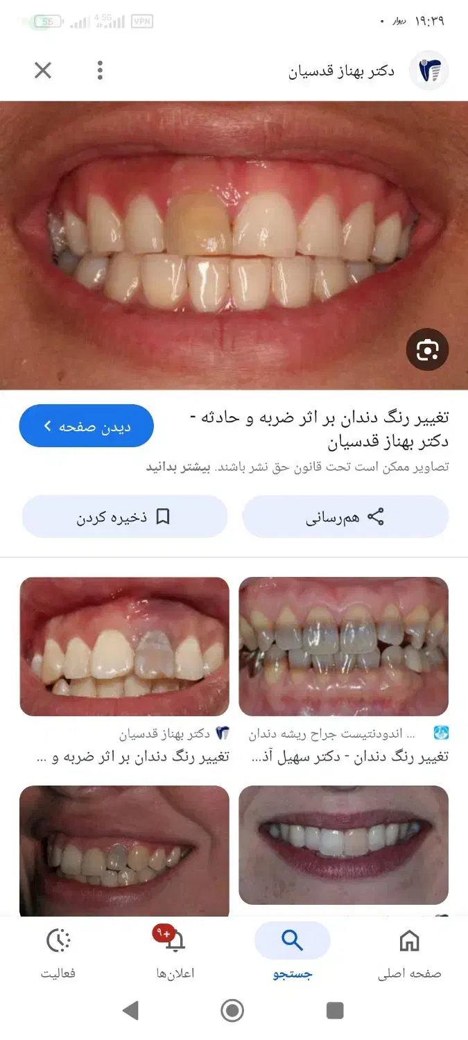 راهنمایی میخاستم/دندان|فعالیت داوطلبانه تحقیقاتی|شیراز, زند|دیوار