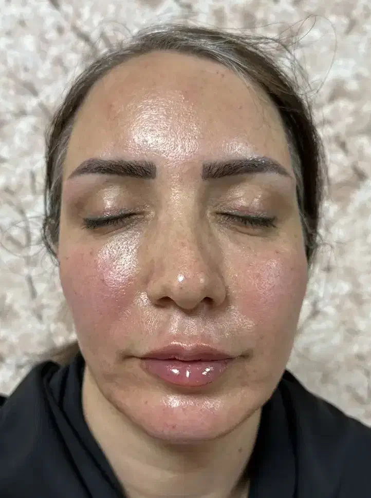 فیلر بوتاکس جوانساز جراحی بادی نخ مزو هیرفیلر|خدمات آرایشگری و زیبایی|تهران, پاسداران|دیوار