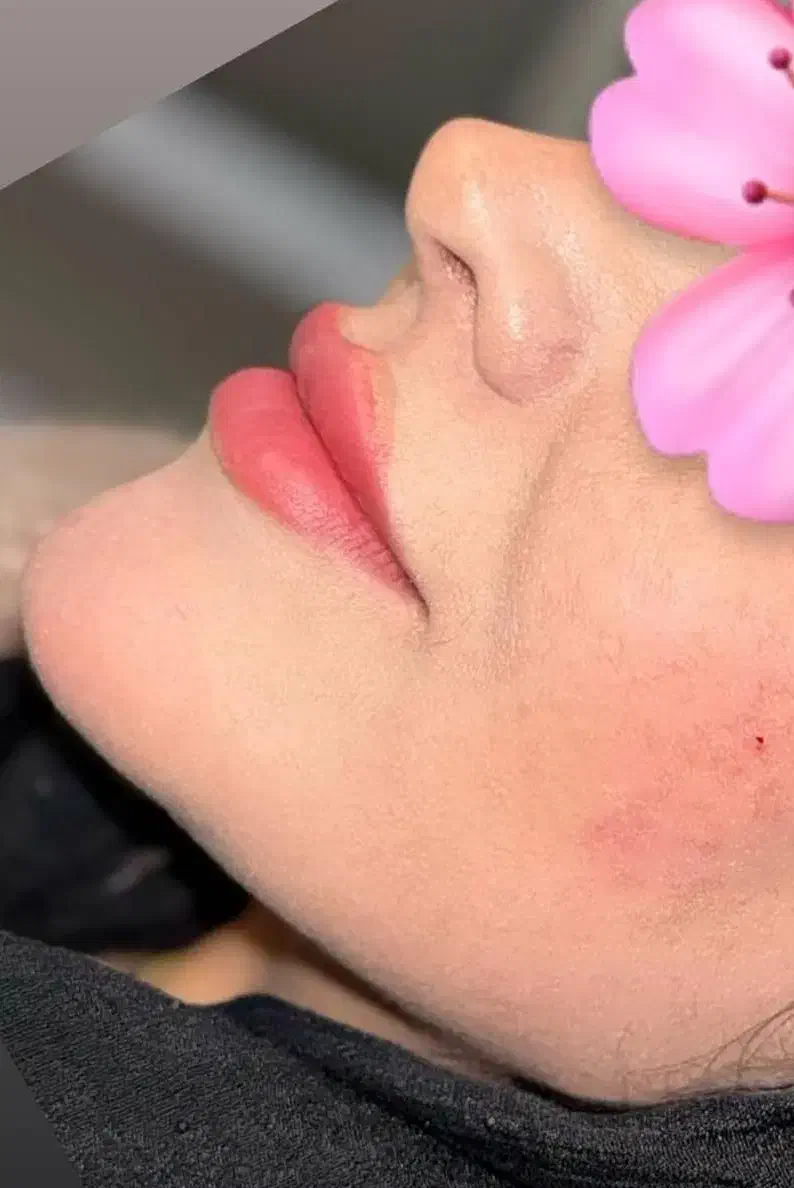 مرکز تخصصی ژل بوتاکس /کاشت امبدینگ لاغری در مطب|خدمات آرایشگری و زیبایی|کرمانشاه, |دیوار