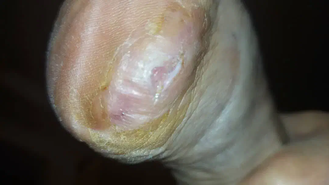 کارشناس زخم پانسمان نوین درمان در منزل|خدمات آرایشگری و زیبایی|ری, اقدسیه|دیوار