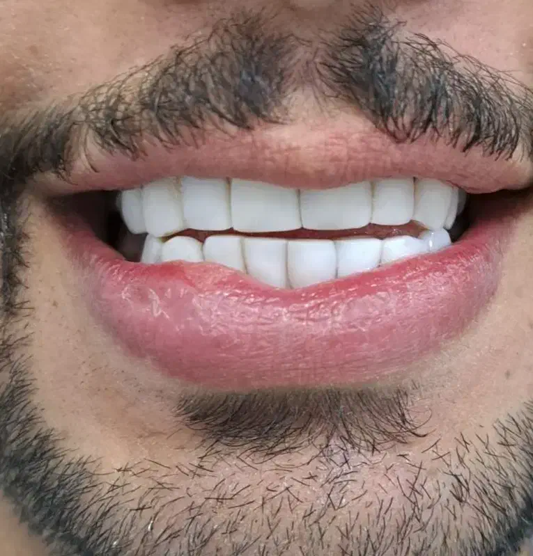 آموزش کامپوزیت دندان۱۰تومن|خدمات آموزشی|اهواز, رسالت|دیوار