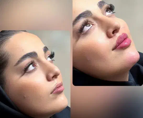 مرکز زیبایی بوتاکس و فیلر و تمامی خدمات زیبایی|خدمات آرایشگری و زیبایی|اصفهان, ملکشهر|دیوار