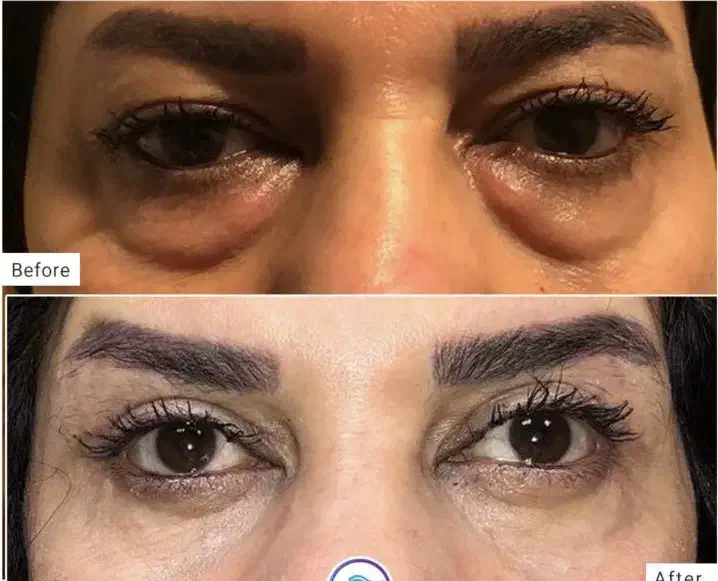 جراحی زیبایی با قیمت فوق العاده مناسب|خدمات آرایشگری و زیبایی|ساری, |دیوار