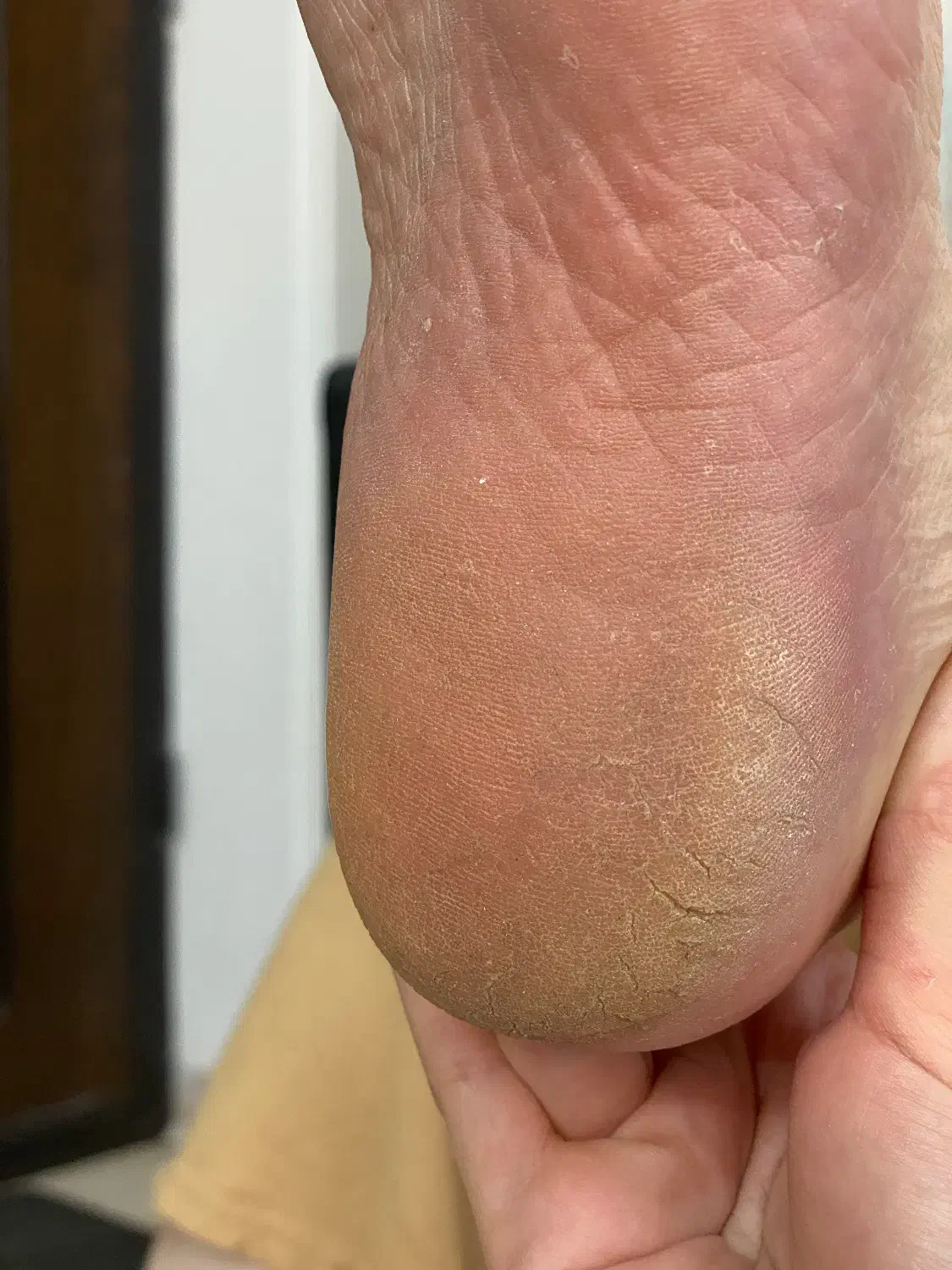 آموزش کفسابی درمانی به مدت محدود|خدمات آموزشی|رشت, جهاد|دیوار