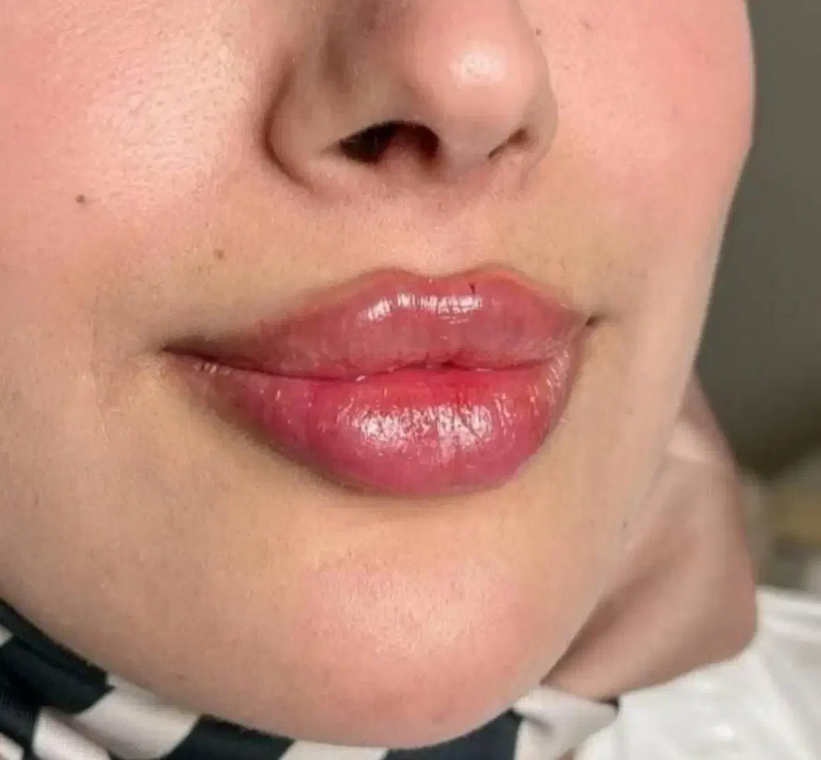 تخفیفات ژل وبوتاکس ومزوژل به مناسبت یلدا|خدمات آرایشگری و زیبایی|قم, زنبیل آباد|دیوار