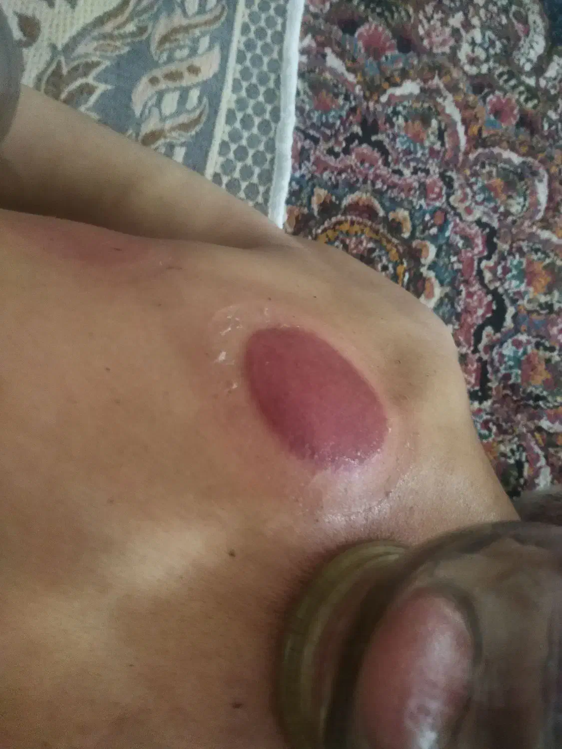 حجامت و بادکشی در منزل|خدمات آرایشگری و زیبایی|بیرجند, |دیوار