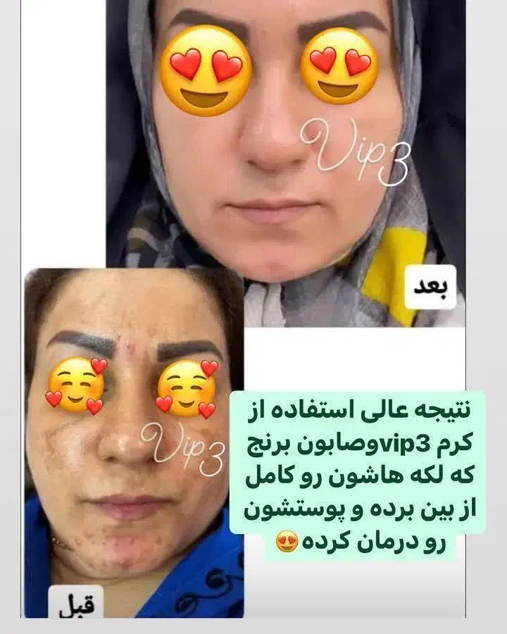 کرم وی آی پی اصلی|آرایشی، بهداشتی، درمانی|همدان, |دیوار