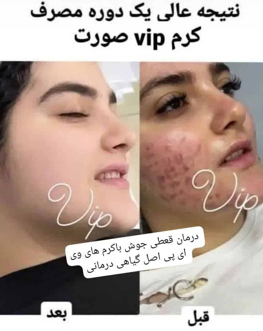 کرم سفیدکننده گیاهیvip|آرایشی، بهداشتی، درمانی|منوجان, |دیوار