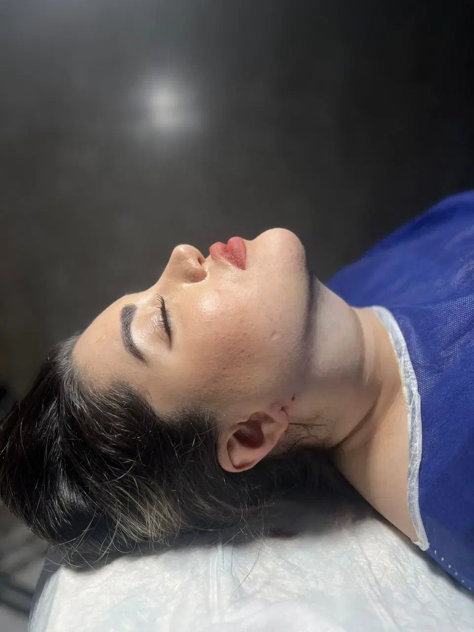 لیپوساکشن غبغب،بوکال فت،فیلرصورت،جوانساز،بوتاکس|خدمات آرایشگری و زیبایی|تهران, شهرک هما|دیوار