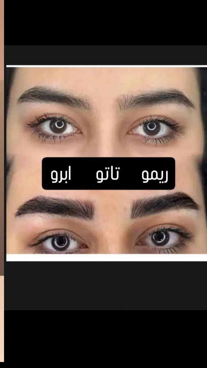 متخصص پاک کردن ریموو تتو ابرو با لیزر|خدمات آرایشگری و زیبایی|مشهد, آزادشهر|دیوار