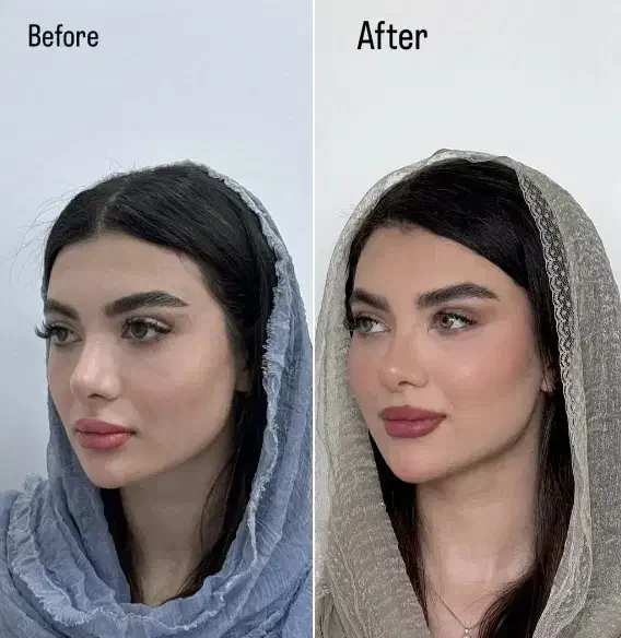 کانتورینگ لیفت فیلر بوتاکس مزو|خدمات آرایشگری و زیبایی|اصفهان, سپاهان‌شهر|دیوار