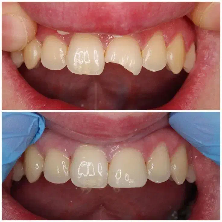 منشی و دستیار دندانپزشک نیمه وقت|استخدام درمانی، زیبایی، بهداشتی|فردیس, سرحدی|دیوار
