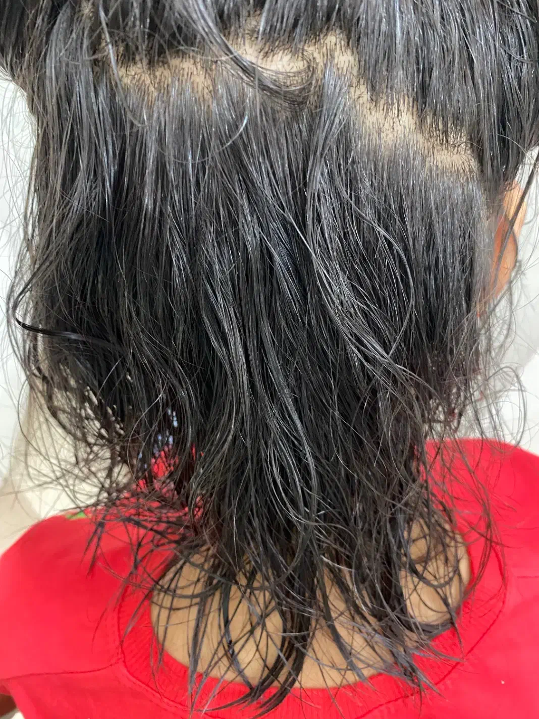 رفع قطعی شپش|آرایشی، بهداشتی، درمانی|اردکان, |دیوار