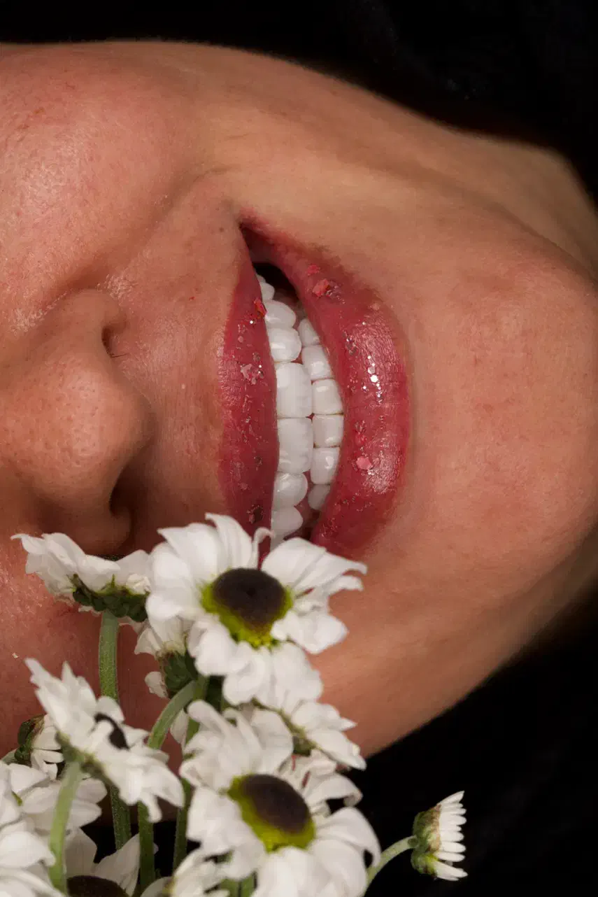 کامپوزیت دندان روش لیرینگ با ضمانت|خدمات آرایشگری و زیبایی|مشهد, فلسطین|دیوار