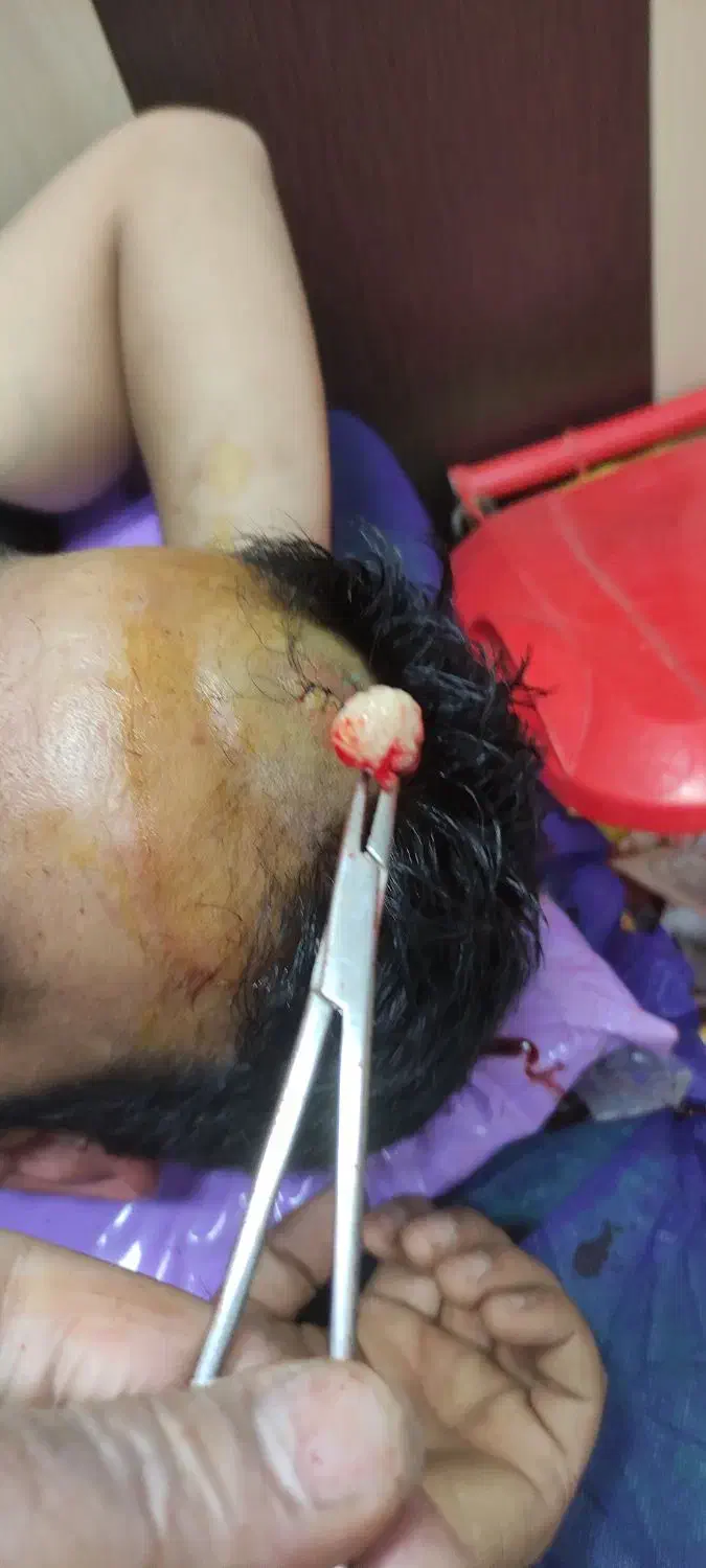 پانسمان وجراحی های سرپایی،ختنه،زگیل تناسلی|خدمات آرایشگری و زیبایی|اهواز, شریعتی جنوبی|دیوار