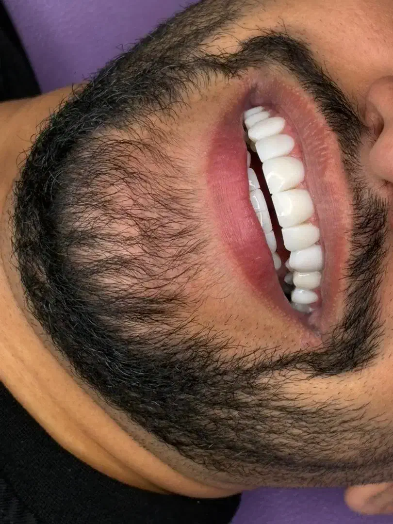 جشنواره پائیز کامپوزیت لمینت|خدمات آرایشگری و زیبایی|تهران, مدائن|دیوار