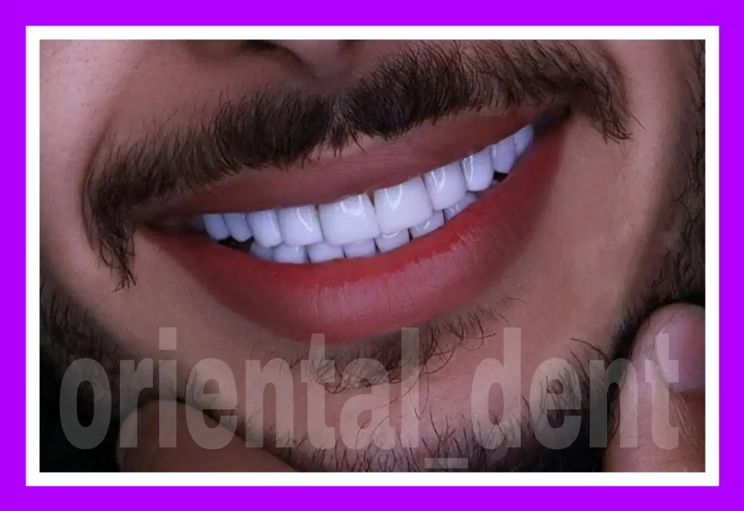 دندانپزشکی اقتصادی/کامپوزیت دندان/عصبکشی/ترمیم|خدمات آرایشگری و زیبایی|تهران, میدان ولیعصر|دیوار