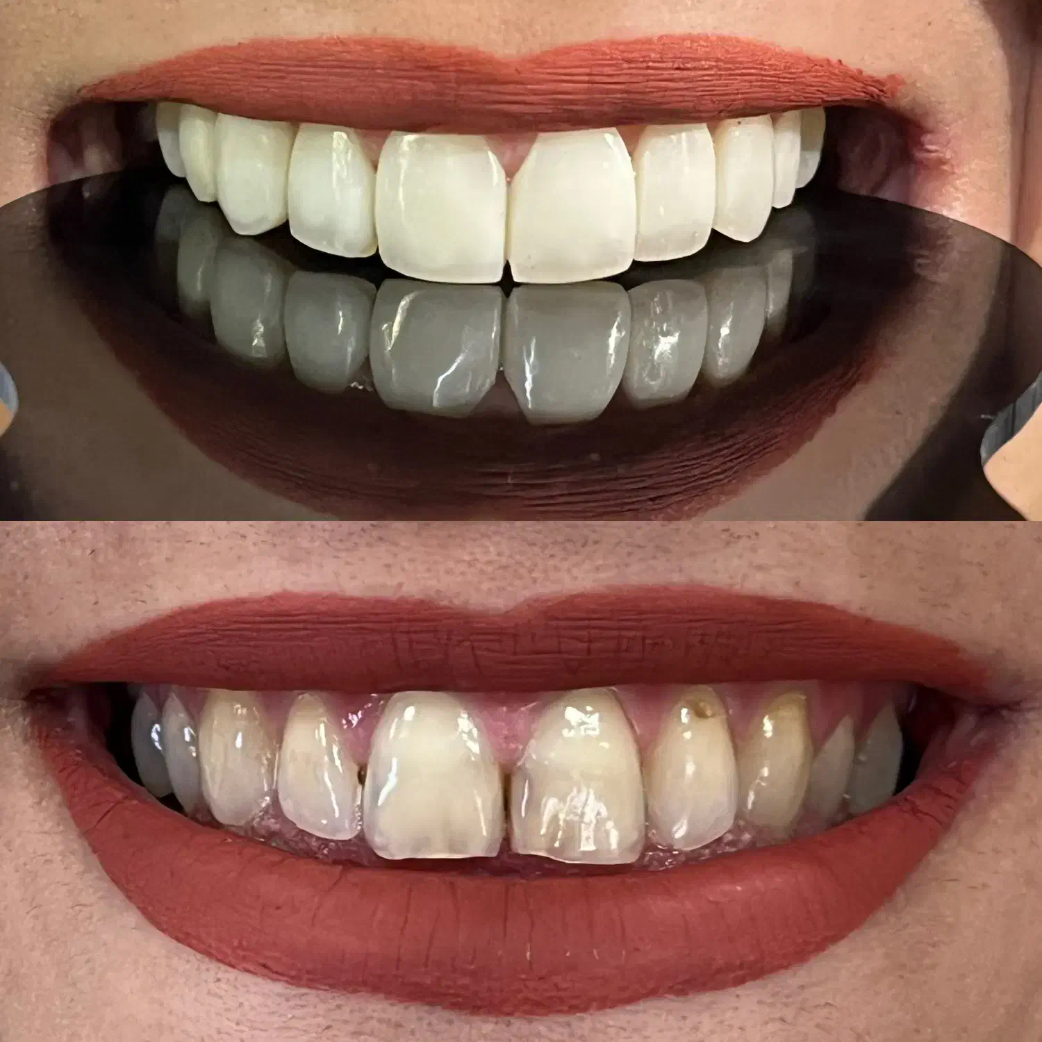 ونیر کامپوزیت ژاپنی اصل (تعرفه دولتی + اقساط)|خدمات آرایشگری و زیبایی|علیآباد کتول, |دیوار