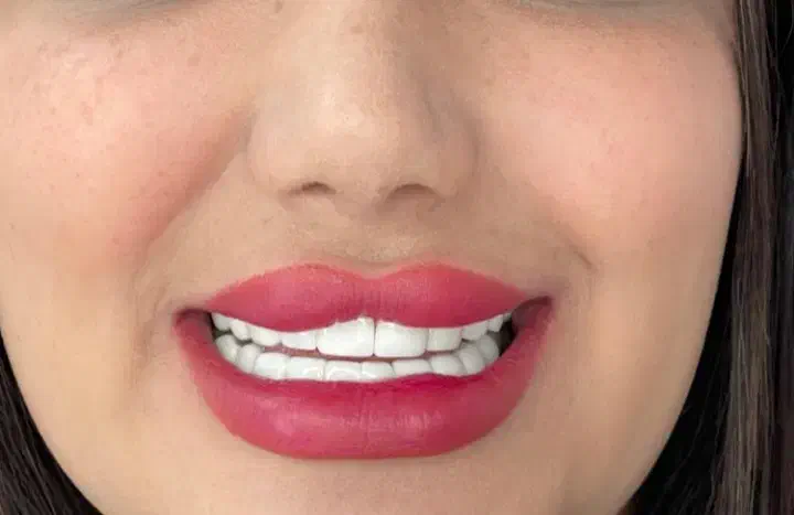 افر ویژه کامپوزیت دندان مواد تضمینی و اصلی|خدمات آرایشگری و زیبایی|کرج, گوهردشت|دیوار