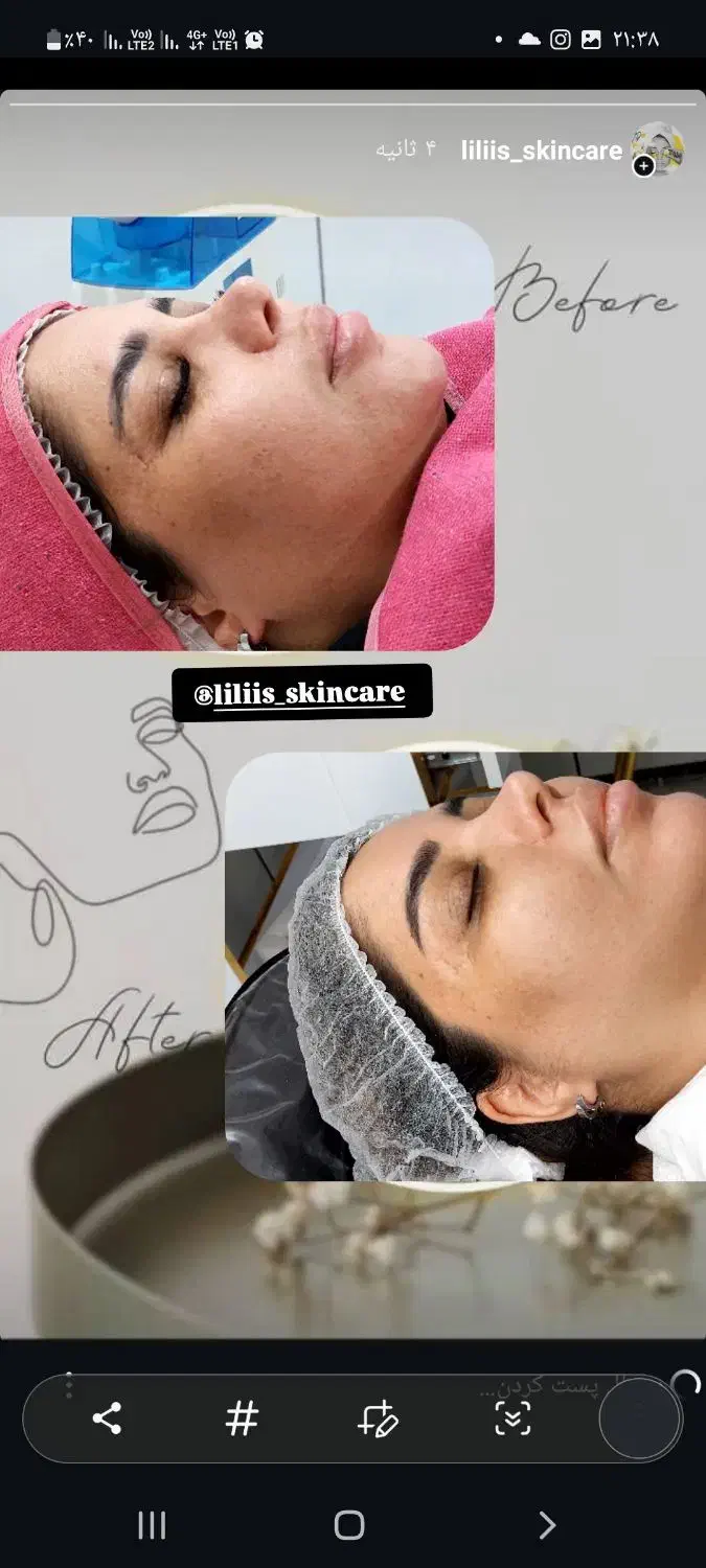 فیشیال و پاکسازی پوست|خدمات آرایشگری و زیبایی|اهواز, رسالت|دیوار