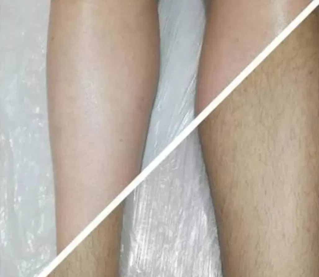 اپلاسیون تخصصی|خدمات آرایشگری و زیبایی|ایرانشهر, |دیوار