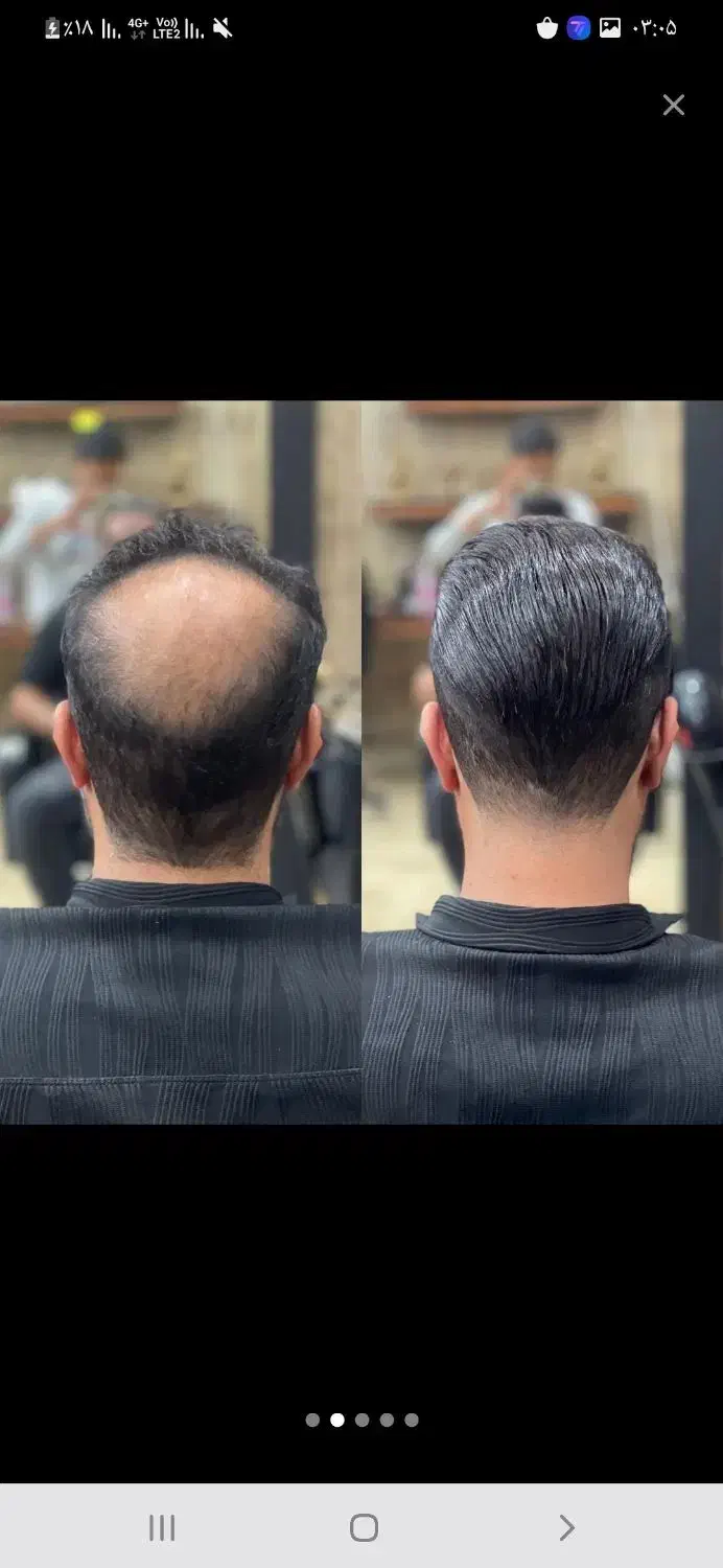 پروتز تخصصی مو ، فر شش ماه|خدمات آرایشگری و زیبایی|قم, بنیاد|دیوار