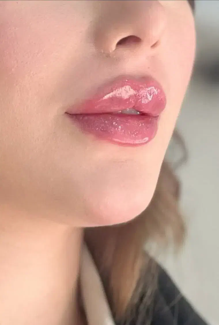 تزریق فیلر بادی بدن۱۲۰هزار|خدمات آرایشگری و زیبایی|جوانرود, |دیوار