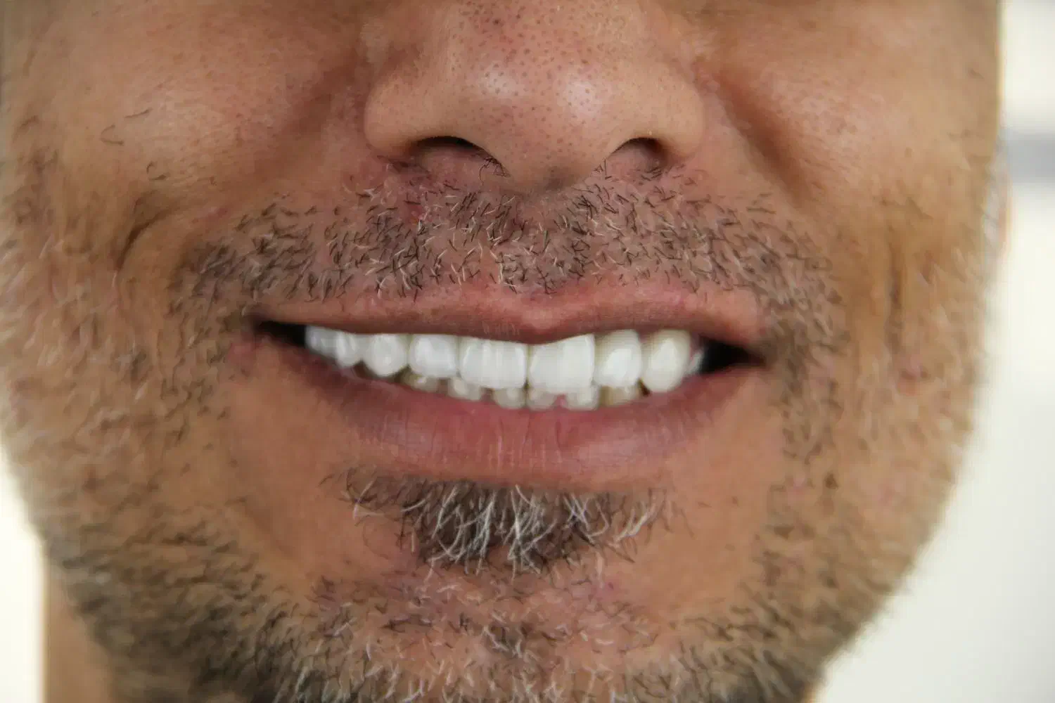 مرکز تخصصی ایمپلنت دیجیتال..|خدمات آرایشگری و زیبایی|تهران, زعفرانیه|دیوار